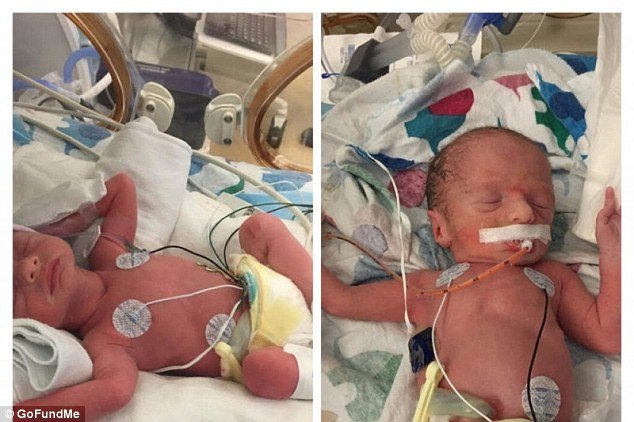 Mãe de gémeos vence cancro, e morre um dia depois de dar à luz