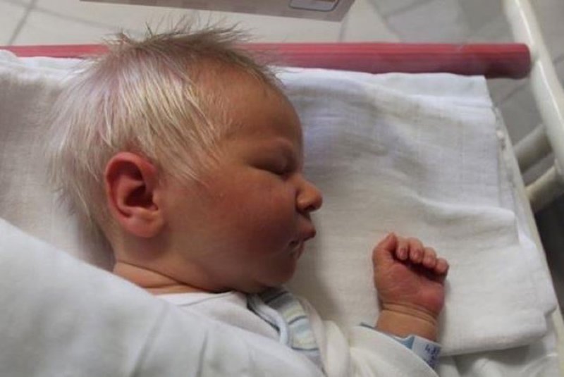 Este bebé nasceu com cabelo branco, e é encantador