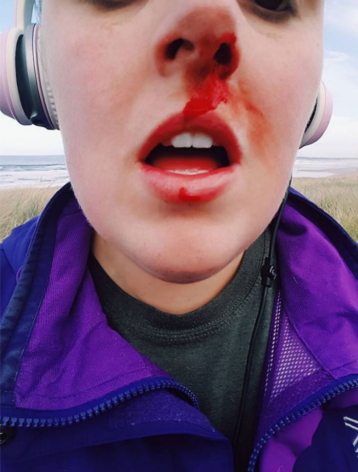 Confrontou jovens que estava a torturar uma foca bebé, e acabou esmurrada no nariz