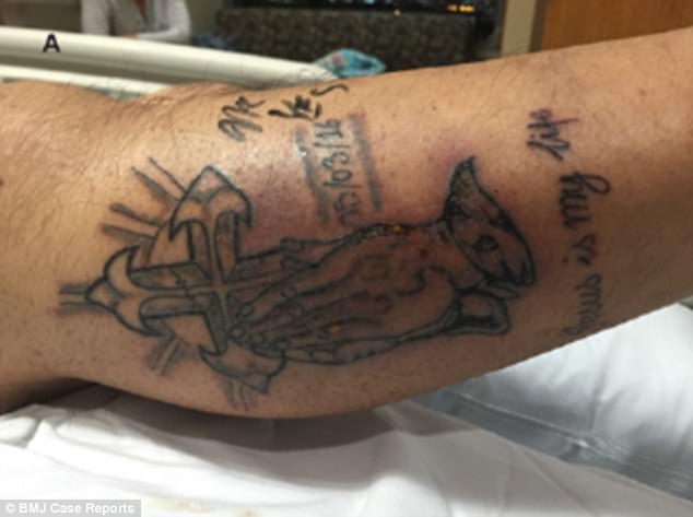 Homem morre com infecção, depois de ir nadar com tatuagem feita há pouco tempo