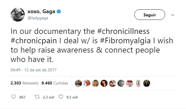 Lady Gaga sofre de Fibromialgia