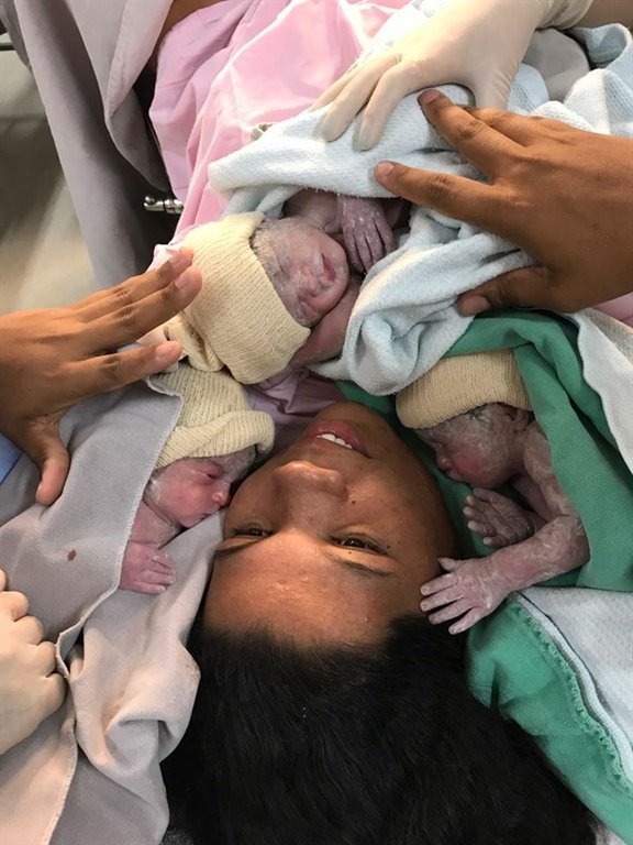 Mulher foi sozinha até ao hospital e deu à luz trigémeas, e de parto natural