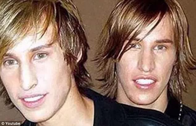 Gémeos gastaram 16.000€ para ficarem parecidos com Brad Pitt