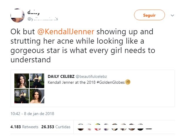 Kendall Jenner desfila no &#8220;red carpet&#8221; com borbulhas na cara e as fãs agradecem&#8230;