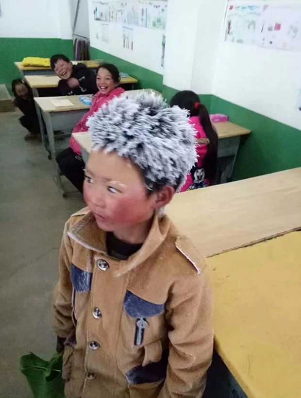 O menino do &#8220;cabelo gelado&#8221; provocou onda de solidariedade na China