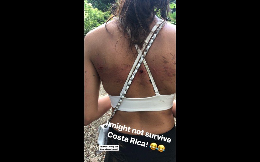 Video: Sara Sampaio feriu as costas e fez slide na Costa Rica