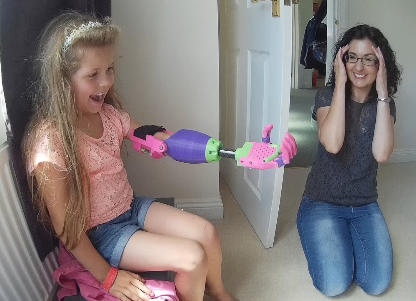 Menina recebe braço artificial feito por impressora 3D