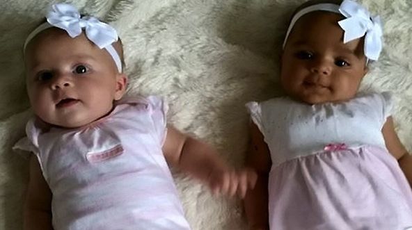 Inglesa dá à luz gémeas com tons de pele diferentes