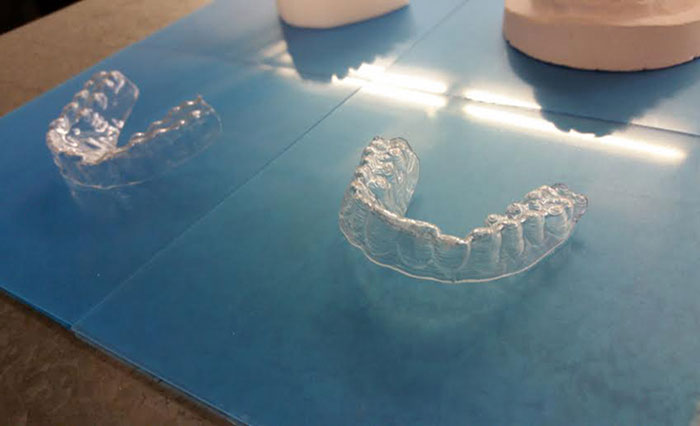 Estudante constrói aparelho para os dentes, e gastou apenas 50€