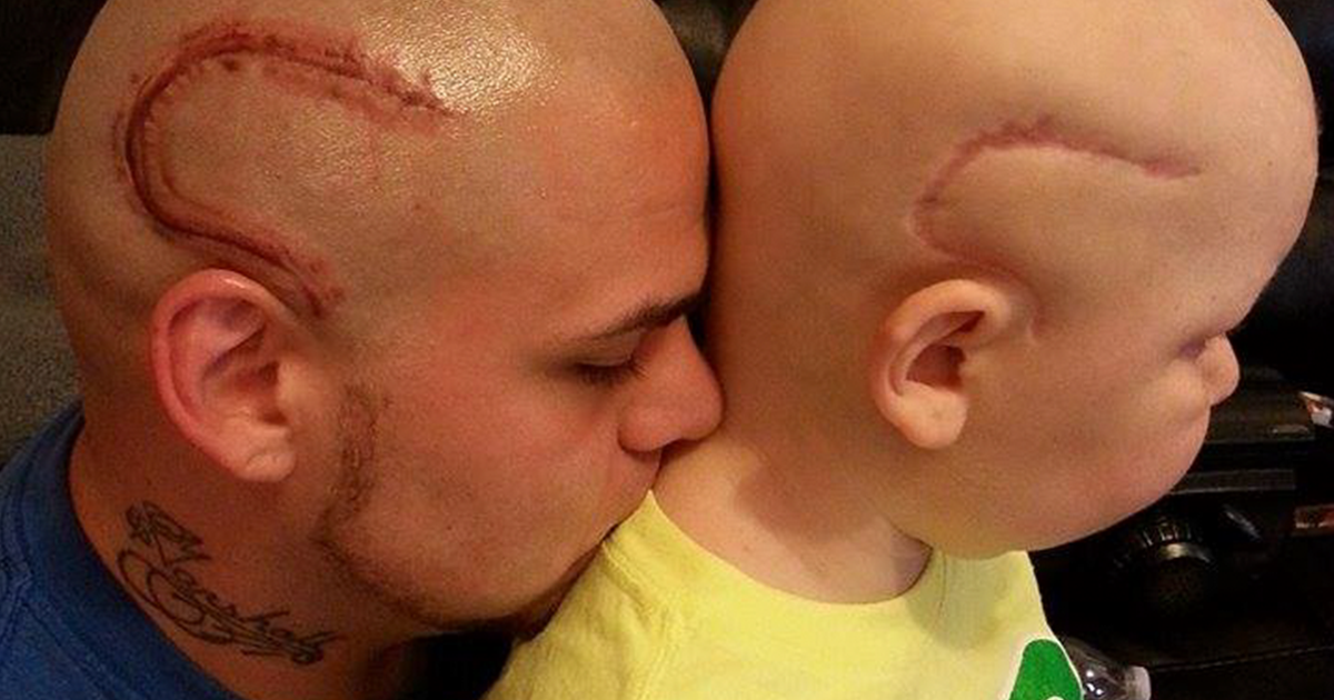 Pai tatua cicatriz do filho operado a um tumor no cérebro, para o ajudar a ganhar confiança