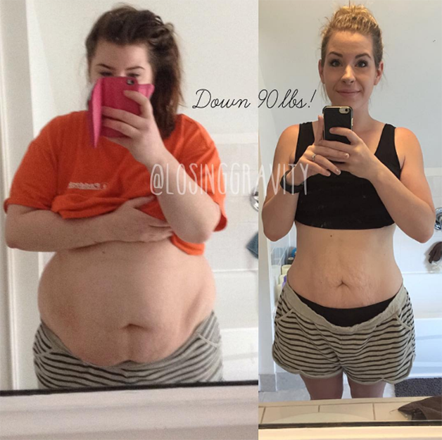 Perdeu 40 quilos e partilhou o lado menos glamoroso da perda de peso