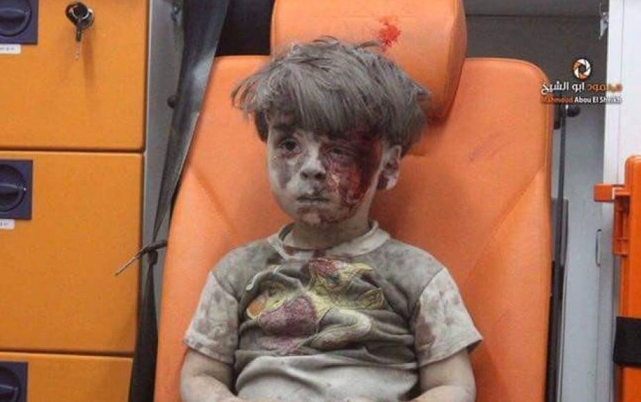 Menino sírio ferido, e sem lágrimas, está a emocionar o mundo