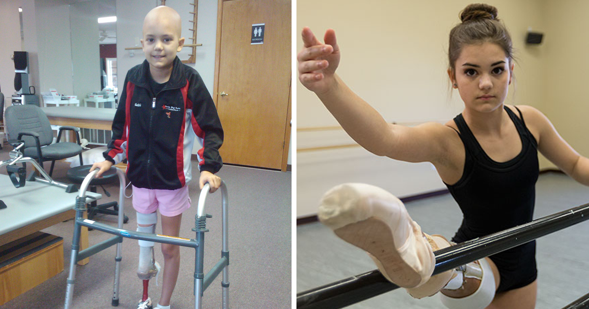 Bailarina de 15 anos, perdeu uma perna para o cancro, mas nunca desistiu