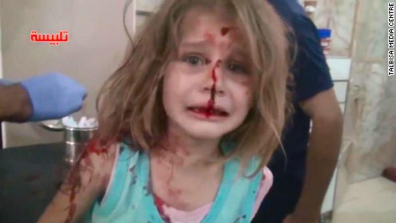 Vídeo de menina síria ferida num ataque está a emocionar o mundo