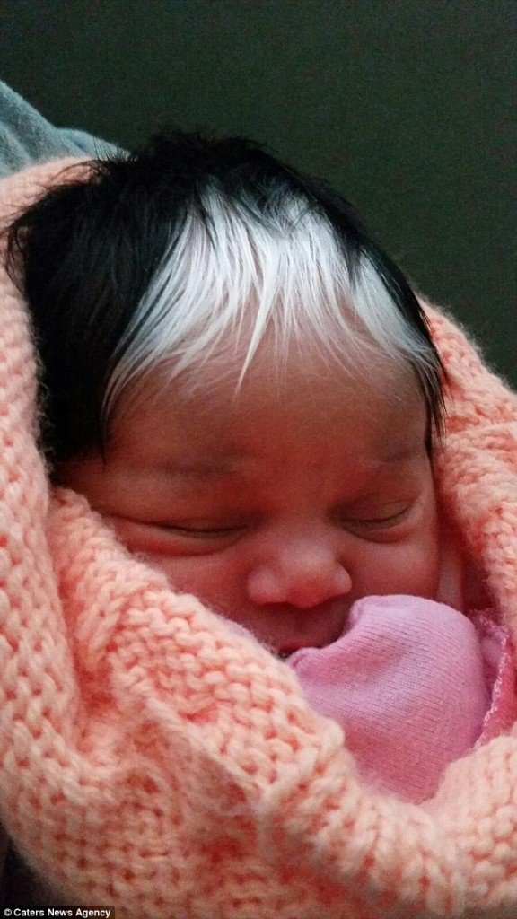 Milli, a bebé que nasceu com uma madeixa branca no cabelo