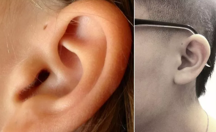 Se tens um buraco extra na orelha, não desesperes. Temos a explicação