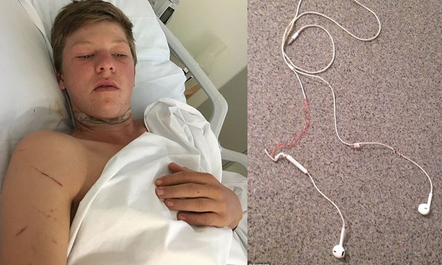 Jovem quase morre decapitado pelo headphones, ao embater de mota numa vedação