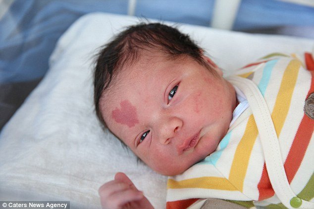 Bebé com marca de nascença em forma de coração está a conquistar a web
