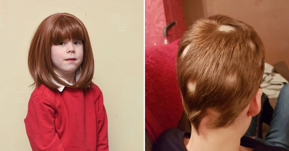 Escola obriga menina de 5 anos com alopecia a retirar peruca em aula de educação física