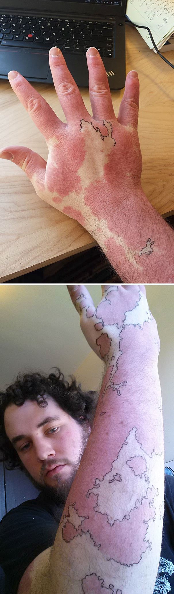 15 marcas de nascença adaptadas de forma genial com tatuagens