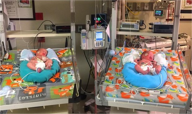 Gémeos nascem em anos diferentes com dois minutos a separá-los