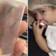 Mãe faz post depois de a filha ter ficado 17 dias com um amendoim preso num pulmão