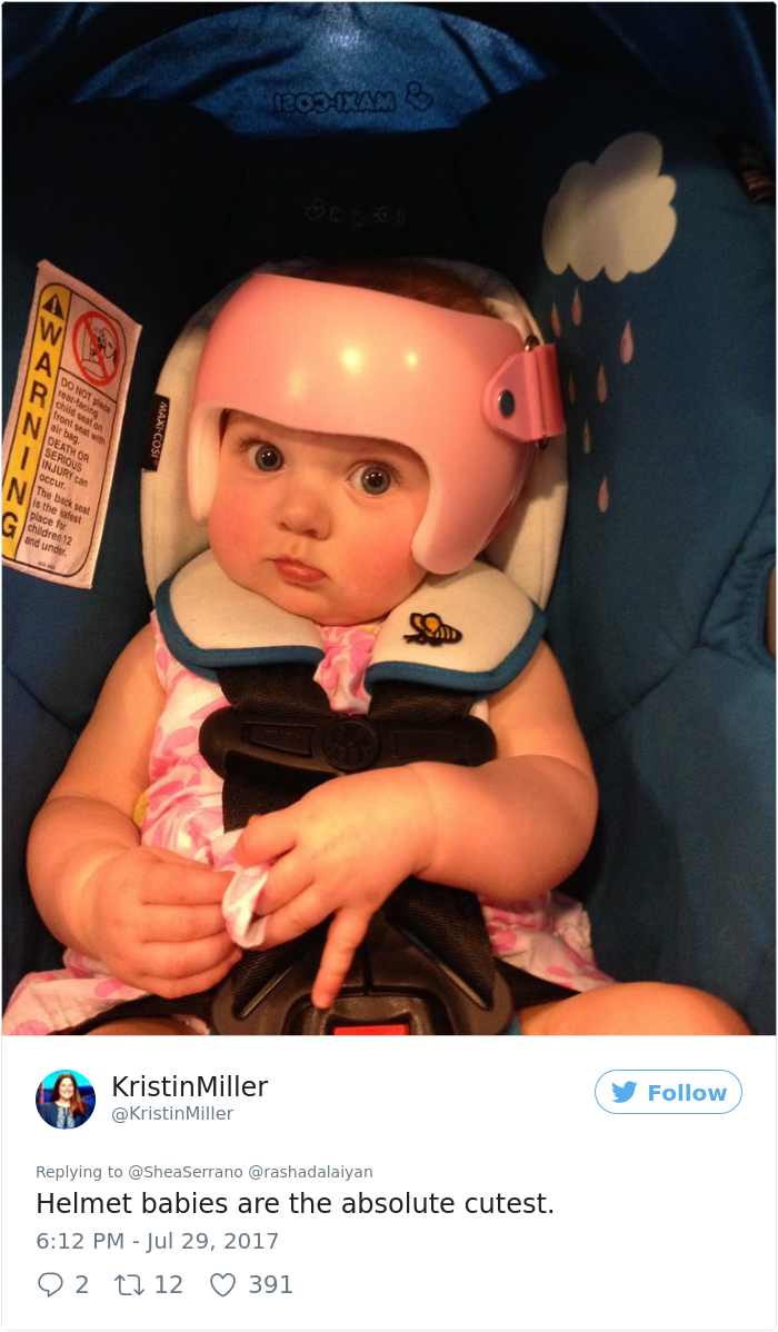 Este bebé tem que usar capacete, e a família decidiu ajudar de forma encantadora