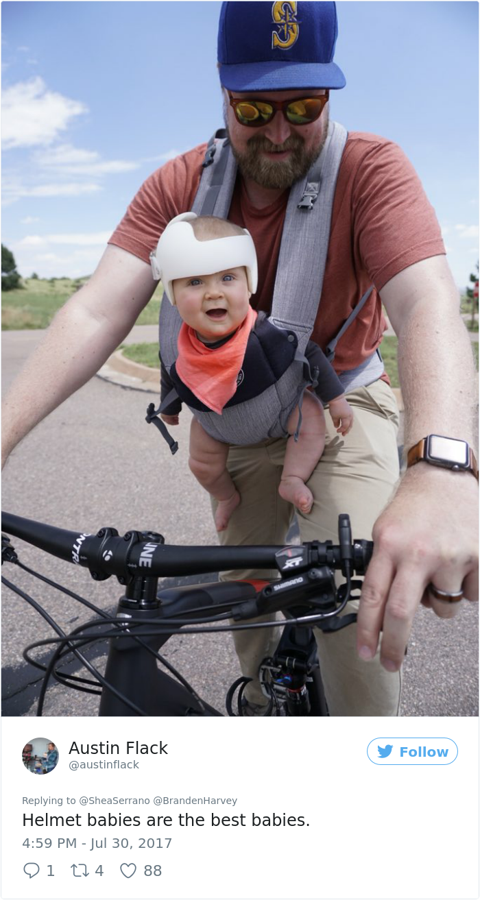 Este bebé tem que usar capacete, e a família decidiu ajudar de forma encantadora