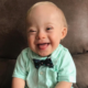 Lucas, o primeiro bebé com Síndrome de Down a ser imagem de marca de comida para bebés
