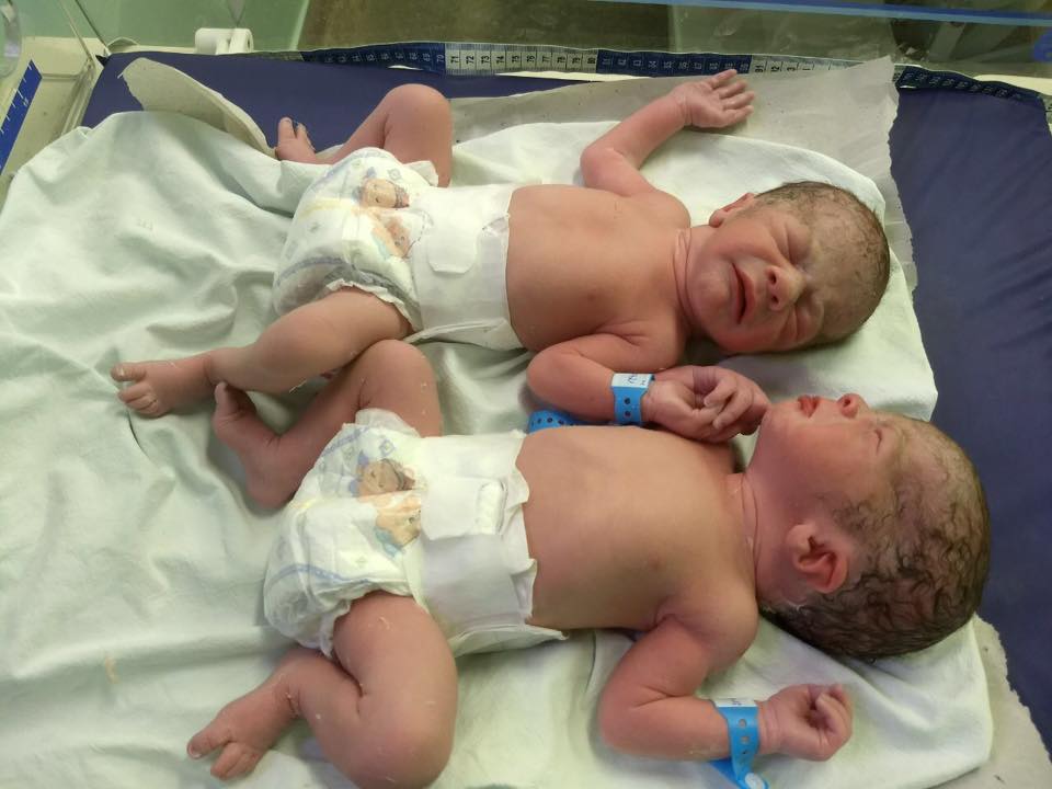 Gémeos de mãos dadas após o parto emocionam família, médicos e enfermeiros