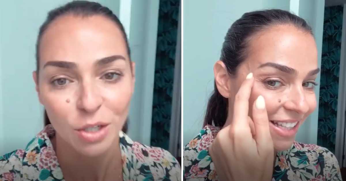 Video: Vanessa Martins faz tratamento com botox e explica resultados
