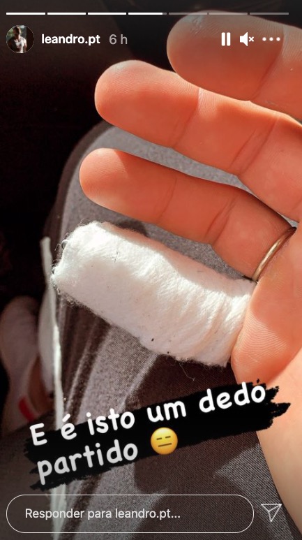 Cantor Leandro sofre pequena lesão: &#8220;E é isto, um dedo partido&#8221;