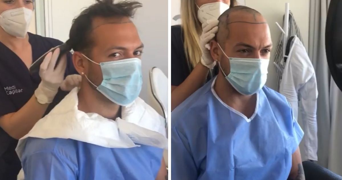 Vídeo: André Abrantes mostra resultado de transplante capilar