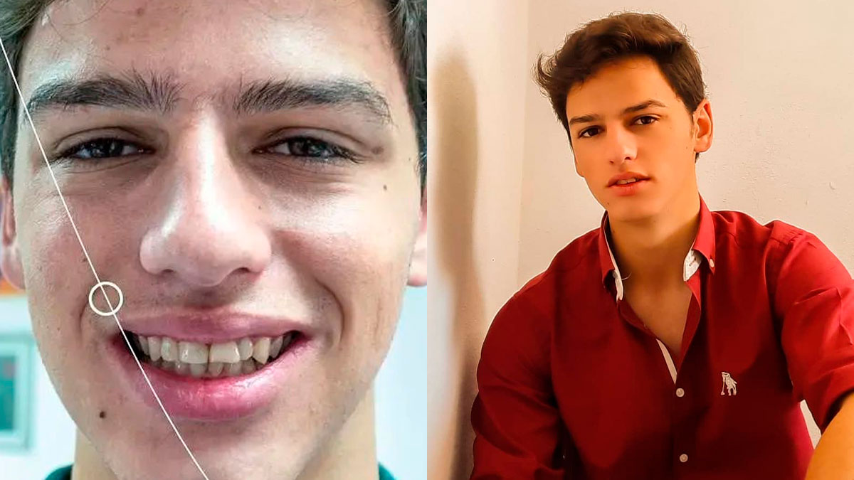 Emocionante! Miguel Moura mostra antes e depois do seu sorriso: &#8220;De lágrimas nos olhos&#8230;&#8221;