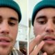 Drama! Justin Bieber sofre paralisia facial e é &#8216;obrigado&#8217; a cancelar concertos: &#8220;Isto é muito sério&#8230;&#8221;