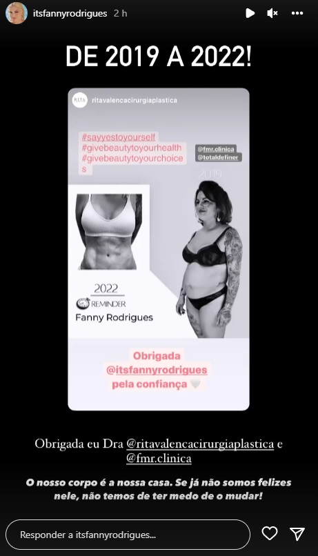 2019 vs. 2022: Fanny Rodrigues impressiona com &#8216;antes e depois&#8217; do seu corpo