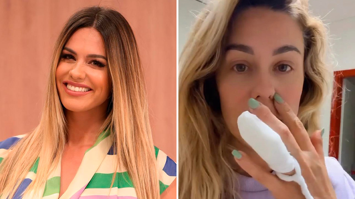 Que susto! Ana Barbosa vai parar às urgências após (grande) inchaço no dedo: “Isto está muito, muito feio…”
