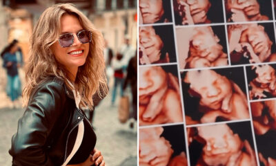 Que bonito! Núria Madruga revela ecografia emocional do bebé: “Até tivemos direito a um sorriso…”