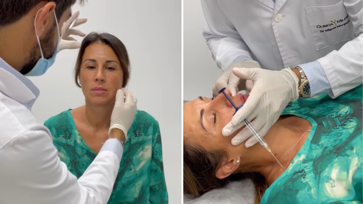 Aos 44 anos, Marta Cardoso submete-se a intervenção estética no rosto. Veja o antes e depois