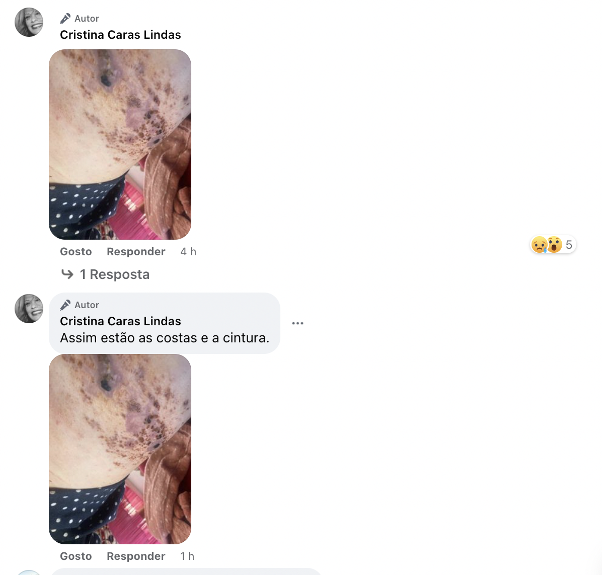 Cristina Caras Lindas revela fotos &#8220;arrepiantes&#8221; e confessa: &#8220;Ainda em grande sofrimento&#8230;&#8221;