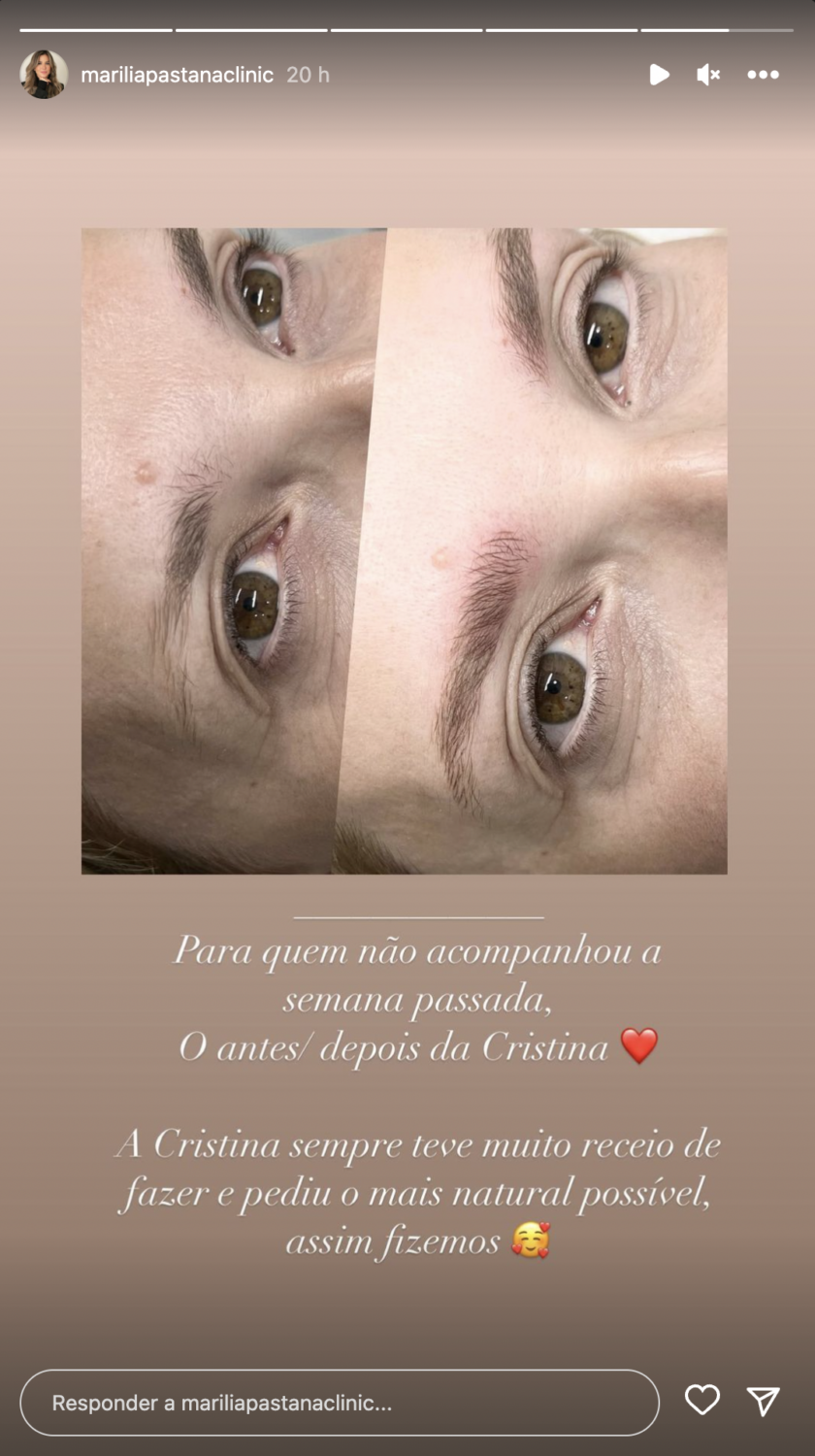 Cristina Ferreira realiza procedimento estético: &#8220;Pediu o mais natural possível&#8230;&#8221;