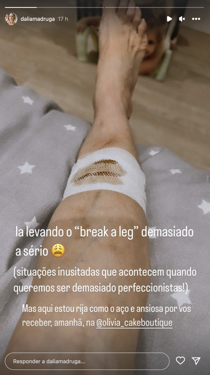 Dália Madruga mostra lesão na perna: &#8220;Quando queremos ser demasiado perfeccionistas&#8221;