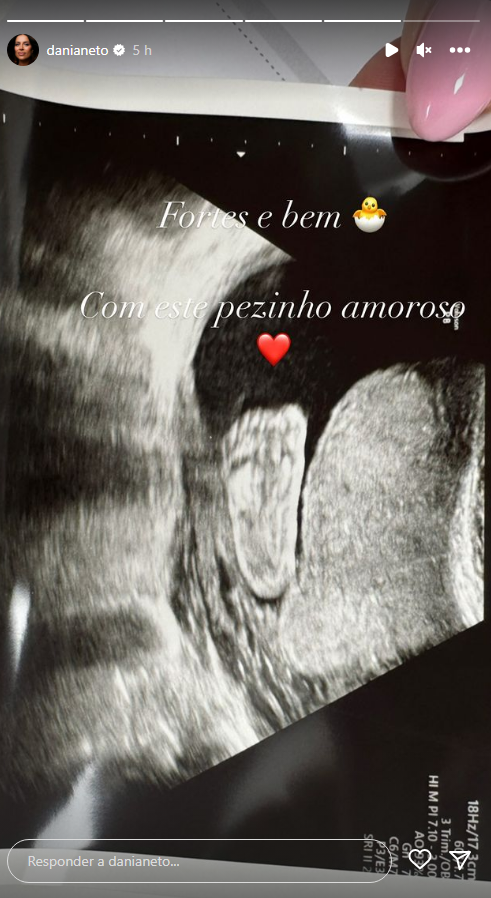 Grávida, Dânia Neto revela fotos da ecografia do bebé: “Com este pezinho amoroso…”