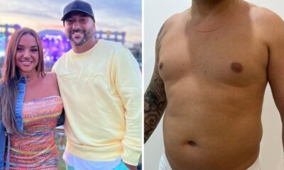 Incrível! Namorado Joana Diniz mostra transformação corporal após cirurgia