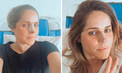 Após &#8220;operação&#8221;, Alice Alves &#8220;atualiza&#8221; sobre estado de saúde: &#8220;A minha primeira anestesia&#8230;&#8221;