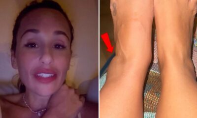 &#8220;Não me conseguia levantar&#8221;. Rita Pereira sofre incidente na rua e mostra lesão